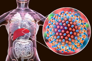 Global Health Initiative: Hepatitis B Awareness