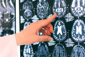 Diploma in prospettive neurolinguistiche