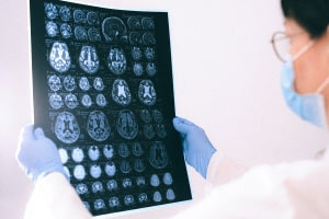 Diploma en Neurofisiología y Neuroinstrumentación